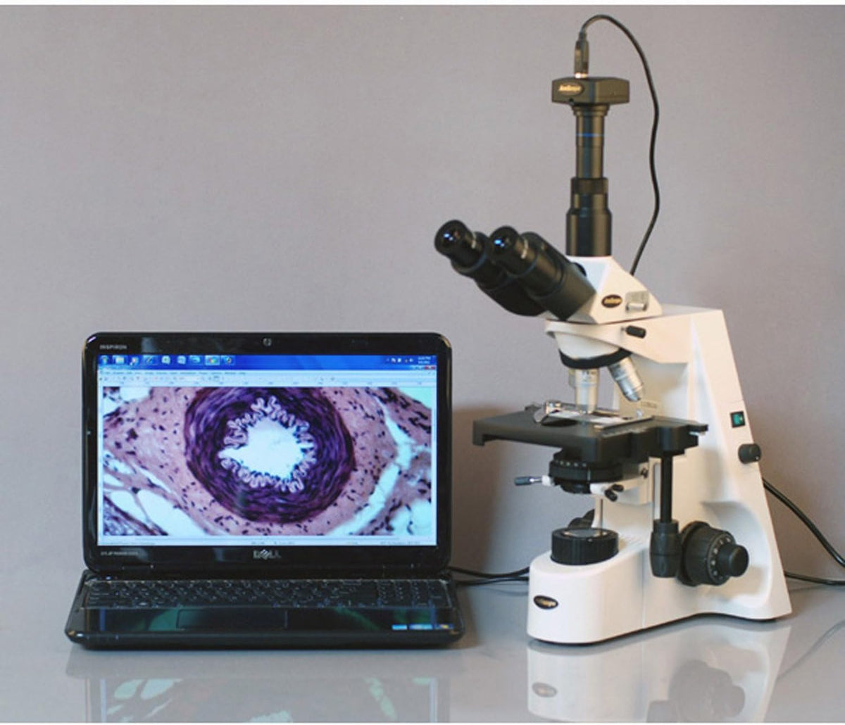 Digital Trinocular Compound Microscope, 40X-2500X Magnification, 5MP Camera C600235